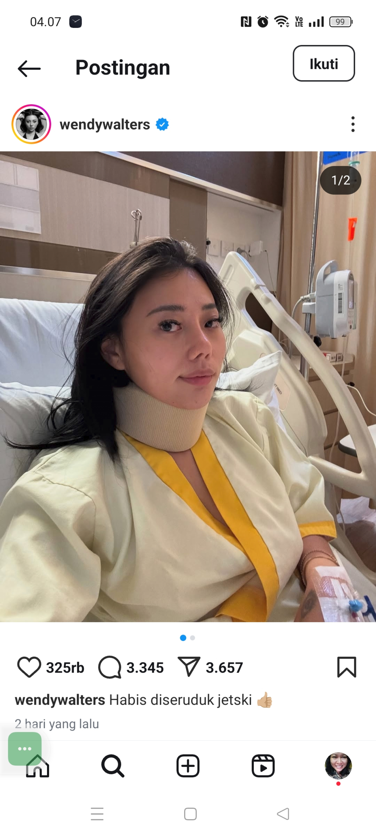 Wendy Walters cedera leher dan kaki usai ketabrak jet ski. (Foto: Instagram)