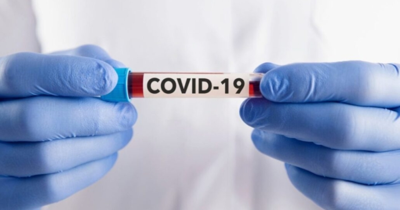 Varian COVID-19 Baru Stratus