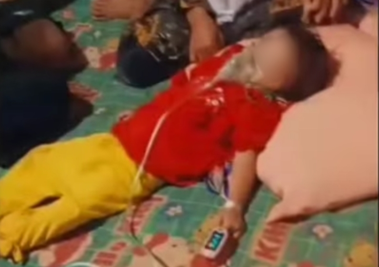 Kisah Pilu Raya, Bocah 3 Tahun Meninggal karena Infeksi Cacing hingga ke Otak