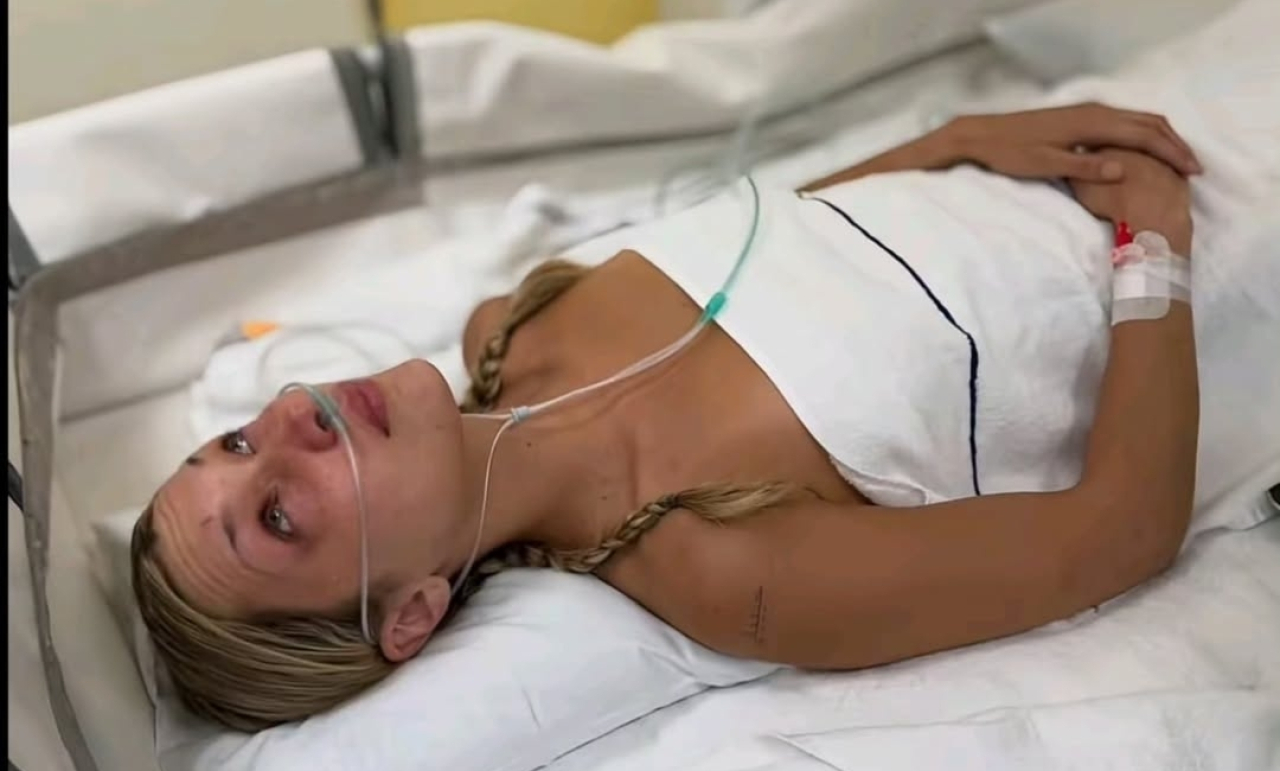 Bella Hadid Perawatan Medis Idap Penyakit Lyme