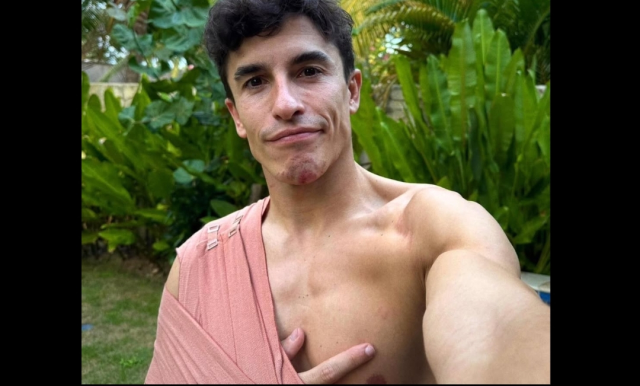 Marc Marquez Absen MotoGP Australia dan Malaysia Usai Kecelakaan di Mandalika